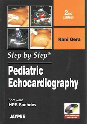 Pediatric Echocardiography