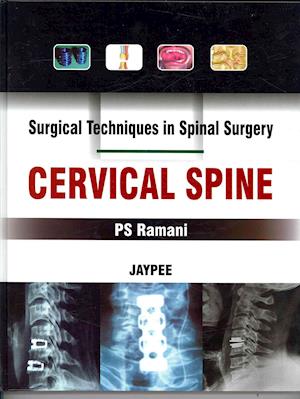 Surgical Techniques in Spinal Surgery: Cervical Spine