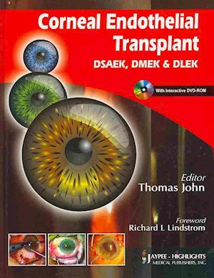 Corneal Endothelial Transplant DSEAK, DMEK and DLEK