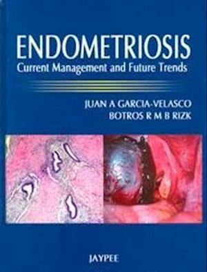 Endometriosis