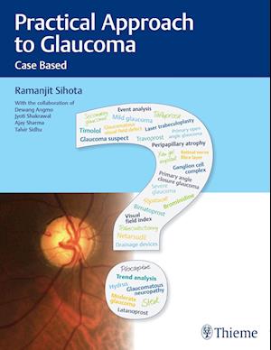 Practical Approach to Glaucoma