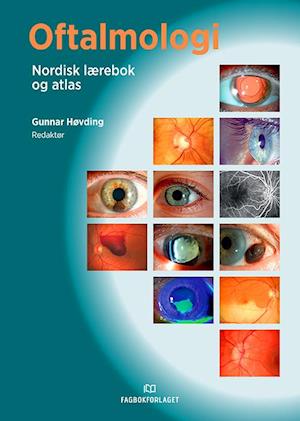 Oftalmologi : nordisk lærebok og atlas  (15.utg.)