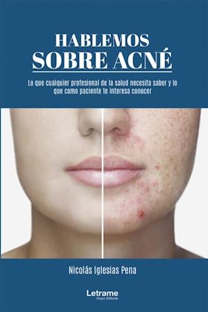 Hablemos sobre acne: 01 (Manual)