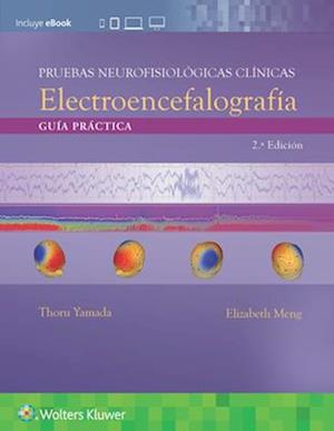 Pruebas neurofisiológicas clínicas. Electroencefalografía