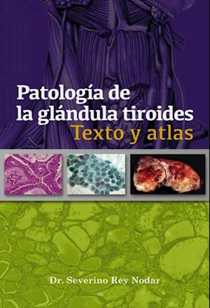 Patología de la glándula tiroides