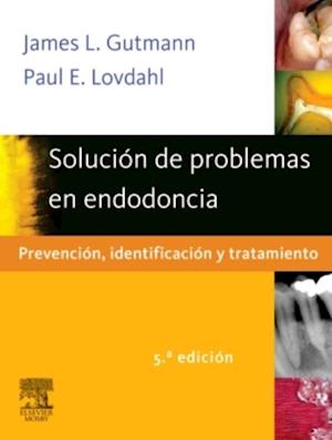 Solución de problemas en endodoncia