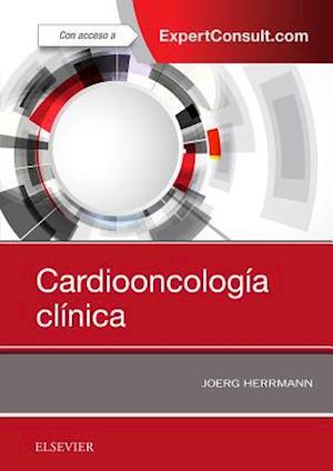 Cardiooncología clínica