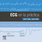 ECG en la práctica