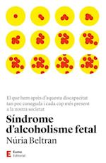 Síndrome d''alcoholisme fetal