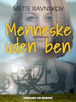 Menneske uden ben