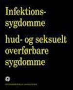 Infektionssygdomme, hud- og seksuelt overførbare sygdomme