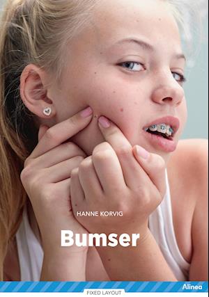 Bumser, Blå Fagklub