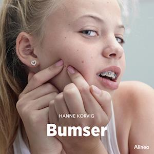 Bumser