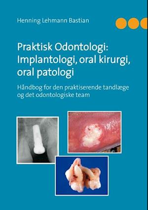 Praktisk odontologi: implantologi, oral kirurgi, oral patologi