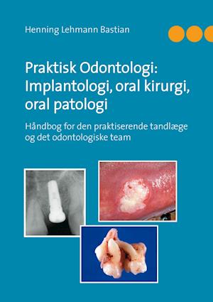 Praktisk Odontologi: Implantologi, oral kirurgi, oral patologi