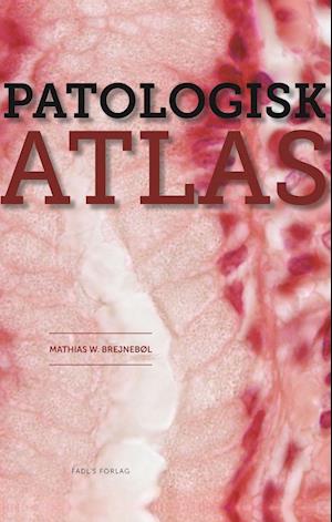 Billede af Patologisk atlas-Mathias Willadsen Brejnebøl
