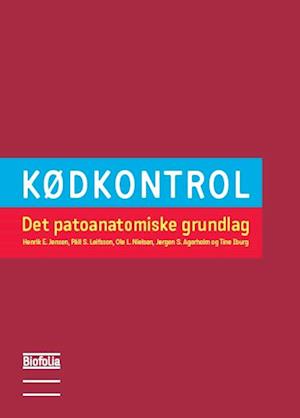 Kødkontrol