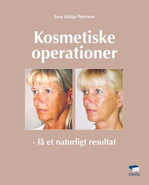 Kosmetiske operationer