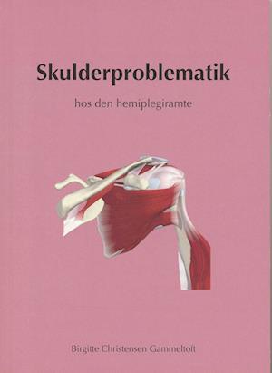 Skulderproblematik og skulderrehabilitering hos den hemiplegiramte