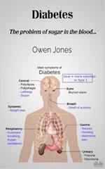 Diabetes: The Problem Of Sugar In The Blood... 