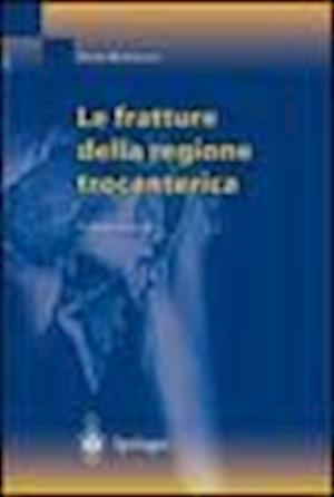 Le fratture della regione trocanterica