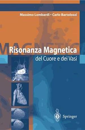 Risonanza Magnetica del Cuore E Dei Vasi