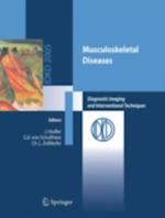 Musculoskeletal Diseases