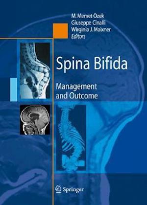 Spina Bifida