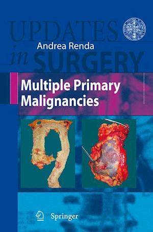 Multiple Primary Malignancies