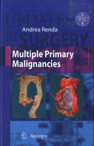 Multiple Primary Malignancies