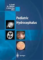 Pediatric Hydrocephalus