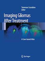 Imaging Gliomas After Treatment