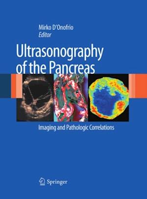 Ultrasonography of the Pancreas