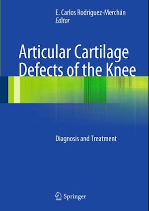 Articular Cartilage Defects of the Knee