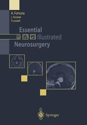 Essential Illustrated Neurosurgery