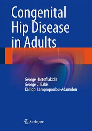 Congenital Hip Disease in Adults