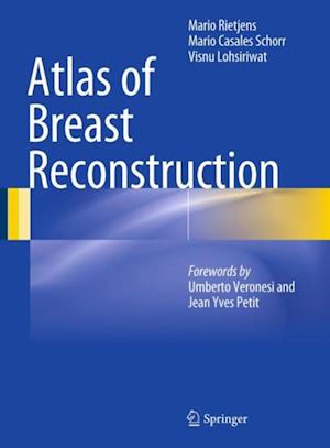 Atlas of Breast Reconstruction