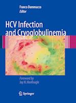 HCV Infection and Cryoglobulinemia