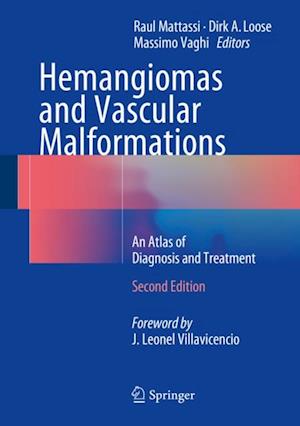 Hemangiomas and Vascular Malformations