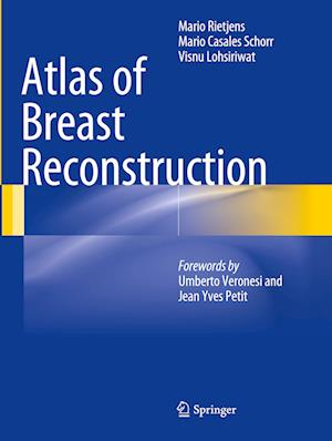 Atlas of Breast Reconstruction