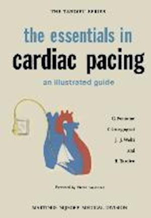 the essentials in cardiac pacing