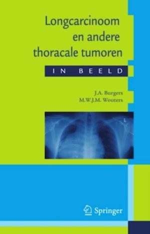 Longcarcinoom en andere thoracale tumoren in beeld