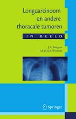 Longcarcinoom en andere thoracale tumoren in beeld