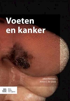 Voeten En Kanker