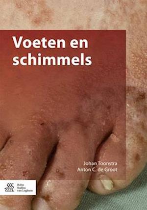 Voeten En Schimmels