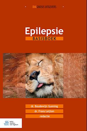 Epilepsie