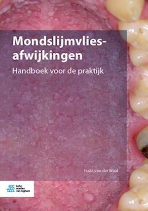 Mondslijmvliesafwijkingen