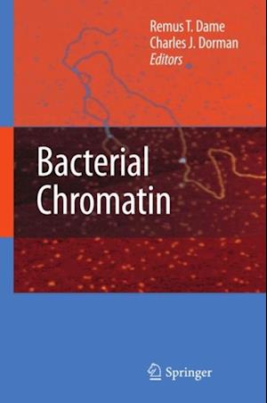 Bacterial Chromatin