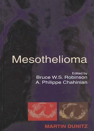 Mesothelioma