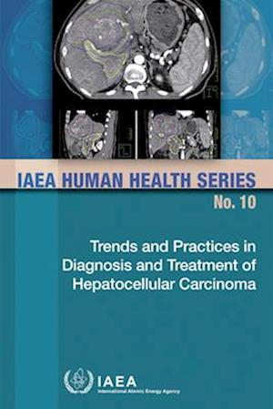 Trends and Practices in Diagnosis and Treatment of Hepatocellular Carcinoma